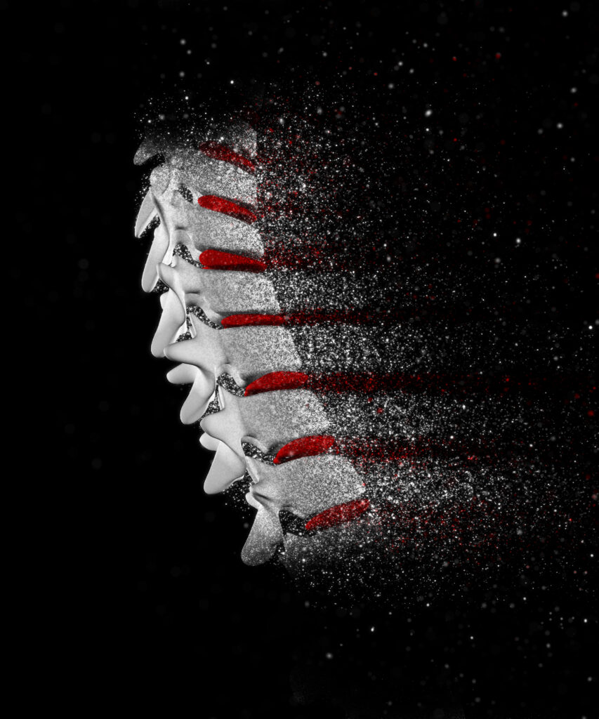 Spine stimulators acting on the spine
