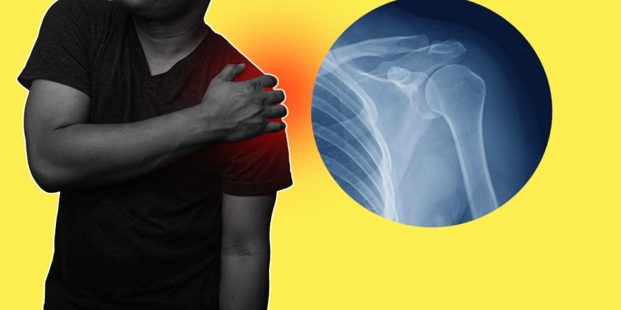 Understanding the Impact of Rotator Cuff Injuries